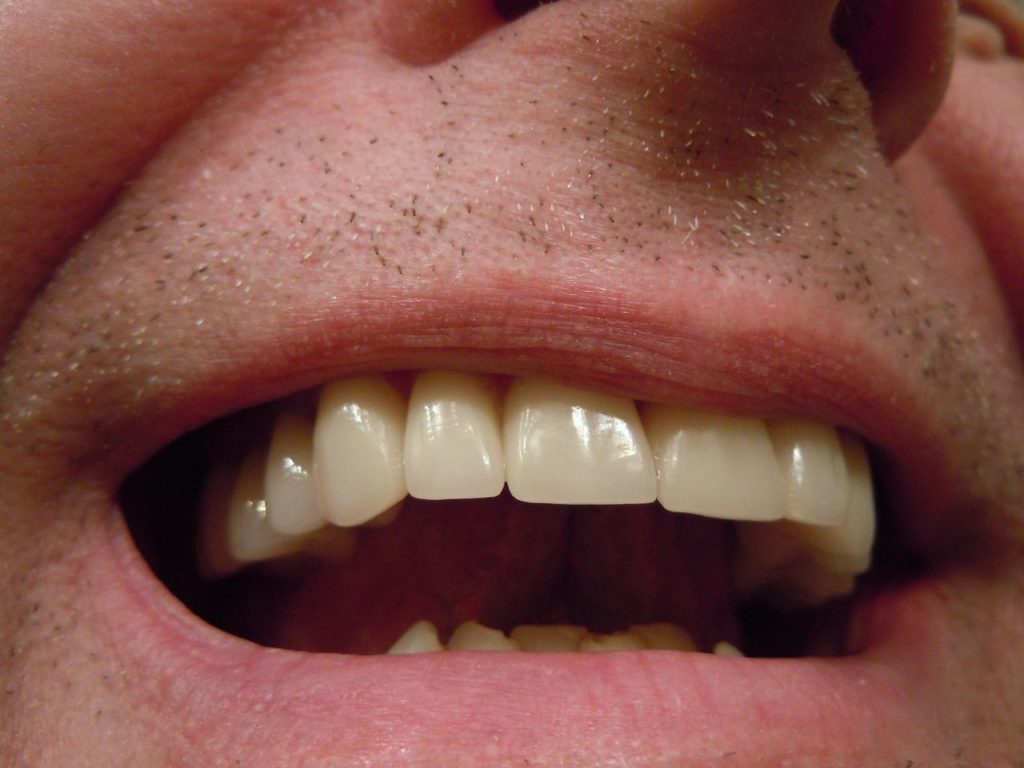 dents-bouche-homme-rasé